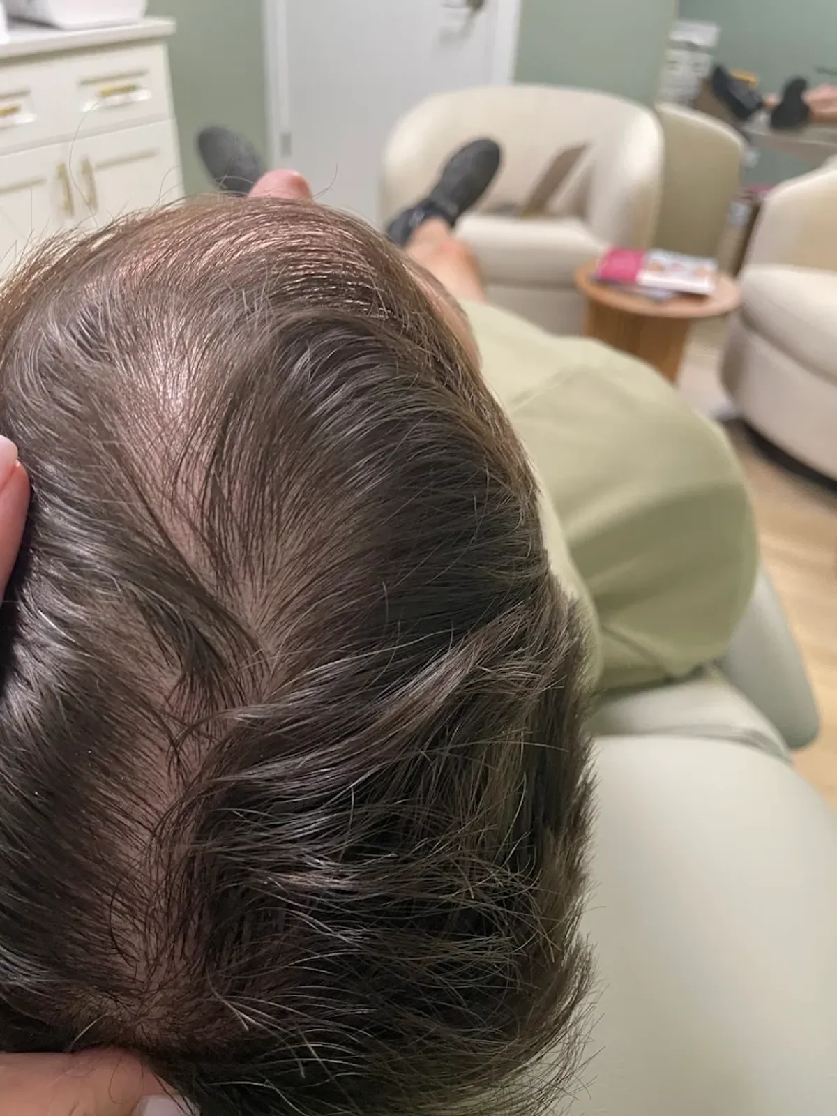 Lyndsay performing a hair regeneration treatment on a patient